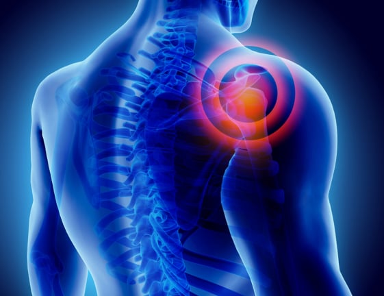 Fisioterapia para ombro