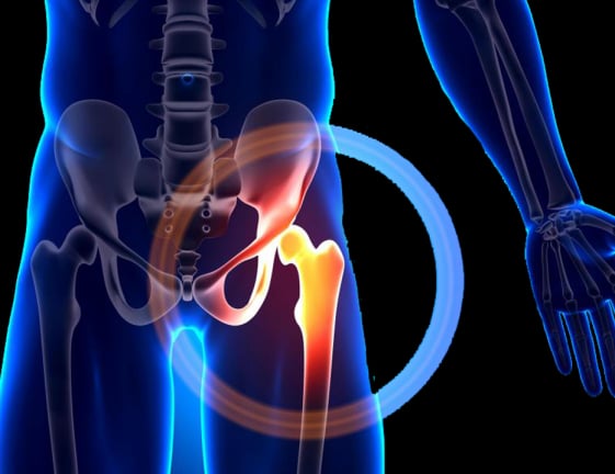 Fisioterapia para quadril